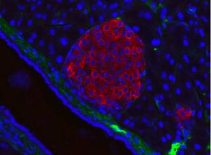 The Real Life Experience of Developing and Commercializing TruGraf, a Validated Non-Invasive Transplant Biomarker thumbnail