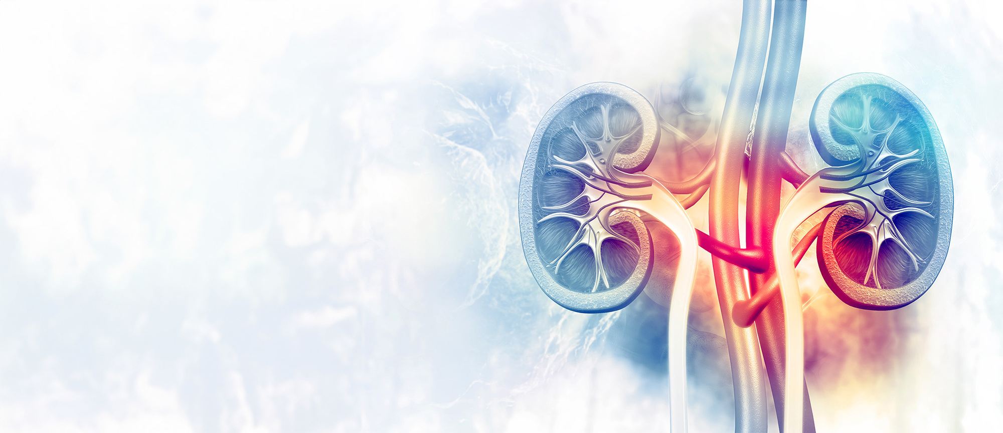 Subclinical Antibody Mediated Rejection Test Viracor TRAC® Kidney dd