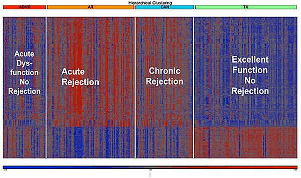 TruGraf blood gene expression transplanted organ rejection test results displaying Acute Dysfunction No Rejection, Acute Rejection, Chronic Rejection, and Excellent Function No Rejection